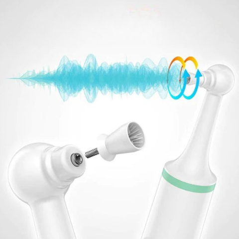 Electric Tooth Descaler - Oral Hygiene & Radiant Smiles